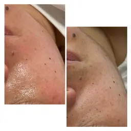 気になる箇所だけ!フェイシャルワックス!