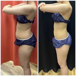 【姿勢矯正/痩身】痩せる身体造り❣️巻いて寝るだけFTI 全身