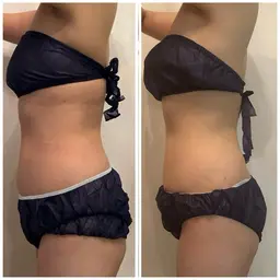 オーダーメイドインディバ120分〈贅沢全身ケア、リフレッシュに！〉