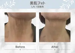 ✨美肌フォト✨首🦋