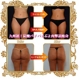 【ぷよ肉を撃退せよ！】オーダーメイドハンド痩身90分