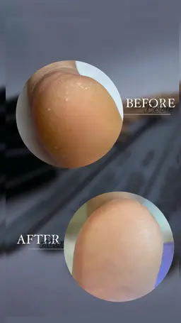 冬前にケアしよう！　かかとのひび割れやカサカサにお悩みの方ににオススメ。