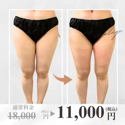 【大人気平日限定★全身１部位】《大型2カップ》冷却＋痩身マッサージ