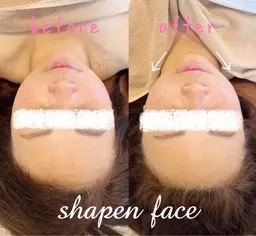 【小顔矯正＋ヘッド】《大口式シャープンフェイス》で自分史上最小の小顔を目指す☆頭のカタチも小さく丸く♪/自律神経整えケア