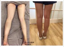 【斬る、削る、削ぎ落とす】パラボラ痩身2パーツ