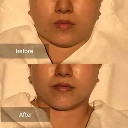 ✨️透明感×ハリツヤ×保湿×リフトアップコース💎✨️