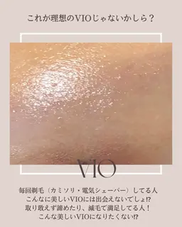 【体験】Vライン👙自己処理不要。たった30分でジョリジョリ不快感から解放！毛穴レスでつるぷる＆赤ちゃんみたいな感触🫶