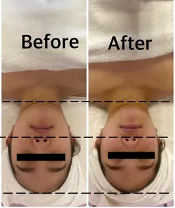 小顔コルギ+初回のみパックor毛穴洗浄付き60分(デコルテ+顔+頭)辛い首肩こりや結果重視の方必見!小顔集中コース!