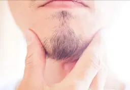 メンズヒゲ脱毛