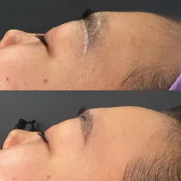 【今話題の❤️‍🔥肌質改善】フェイシャルワックス＆ヒト幹細胞培養液