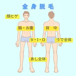 ★当店人気No.2★【全身（顔ヒゲ・VIO込）】脱毛