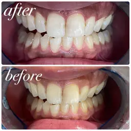 🏫セルフホワイトニング🏫学割‼️初回体験10分×3回　​〜​安心のカウンセリング付き​〜​