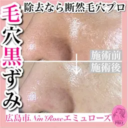 毛穴フェイシャル