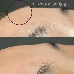 肌質改善🌿ニキビ・毛穴ケアにも◎「潤いシェービング🫧✨」