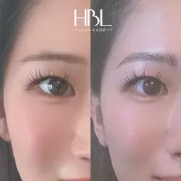 HBL(眉癖改善)💎眉周りwax or シェービング選択可能✨