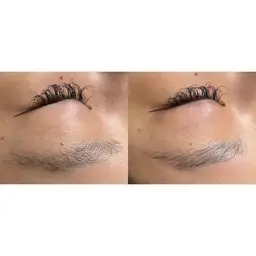 ハリウッドブロウリフト