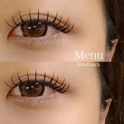 🎀バインドロック140本