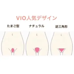 VIO脱毛(メンズNG)