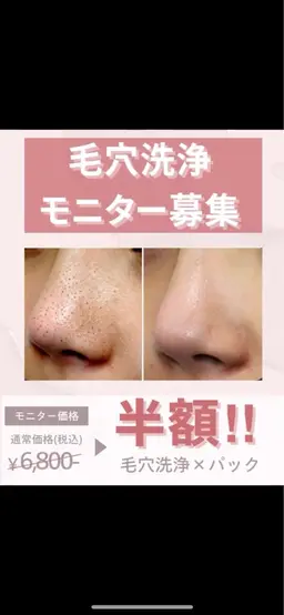 【毛穴洗浄】半額！モニター募集！パック付き