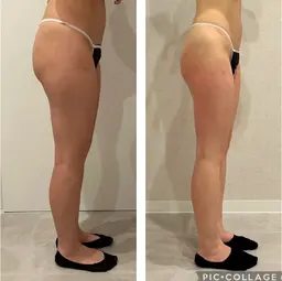 痩身✖️デトックス/60分