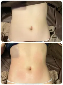 フォースカッター痩身エステお好きなパーツ１箇所6600円が初回のみお試し3300円✨