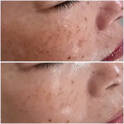 🈹60%off✨水光肌✨モデリングパック付き💆‍♀️最強肌質改善フェイシャル80分