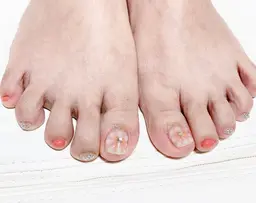 【オフ無し】持ち込みデザイン・パーツ+オイル保湿