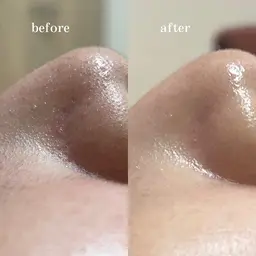 【minimo限定価格】水光肌トリートメント