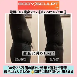 電磁パルス痩身マシン《ボディスカルプト》お試し
