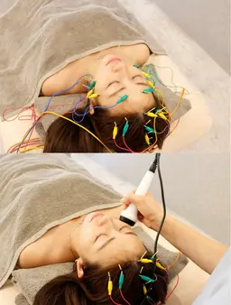 【⭐️人気No2】即撃激的変化/vライン【電気美容鍼＋強力EMS高周波】頭蓋スパ付き】☝️任せて💪むくみ、たるみ、小顔