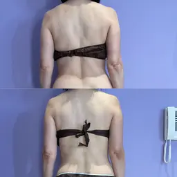 【全員】ミニモ限定！インディバ×インド式エステスーパーデトックス100分