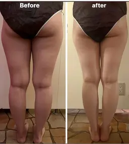 ■ 骨盤深部筋膜ﾘﾘｰｽ➕美脚ｺﾙｷﾞ60分Massage the fat and muscle of the feet