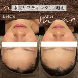 お試し水玉リフティング6分