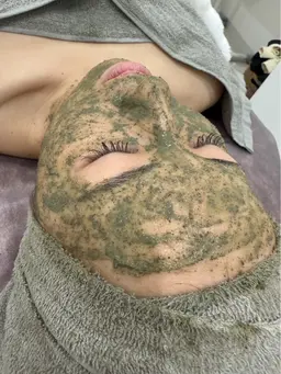 お正月割/ハーブピーリング🌿¥18700→¥9350