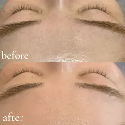 🤍フルフェイシャルワックス🤍￥5,500