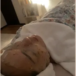 ハイドロジェリーマスク(オプション)