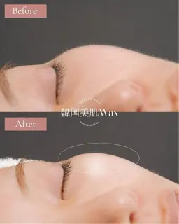 韓国美肌ワックス (2パーツ)美容液たっぷりのフェイスワックス おでこor頬or口周りor鼻or顎から2パーツ選べます!