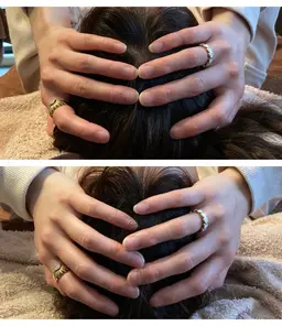 【肩こり】美容鍼×首肩マッサージ×ヘッドスパ　¥14,000→￥6,980