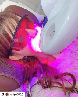 【初回限定】強力集中ケアで理想の白さに✨痛くない超強力ハイパワーホワイトニング‼️合計40分照射💫