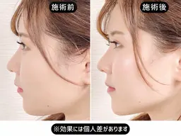 【初回おまかせ】むくみ/エラ/左右差を診断して小顔 60分