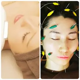 【メラニン・シミ・肌ノイズ】IPLフォト光フェイシャル✨+電気を多数流す美容鍼🪡【ニューハーフ鍼灸師の最強肌管理🌹】