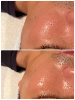 毛穴スッキリ✨『デトックスエステ』