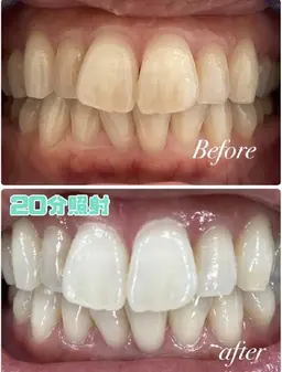 【会員様】回数券のご予約