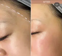 自然な艶肌を目指せるフェイスワックス(全顔)モニター様を募集しております☀️¥2500