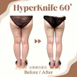 《ミニモ学割》U24 60分ハイパーナイフ◇上半身or下半身