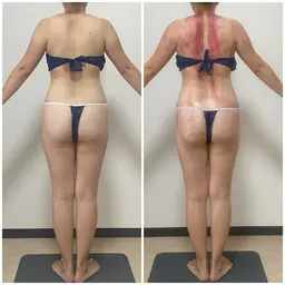 セルライトクラッシュ60分 全身 ➕遠赤外縁ヒートマット付き