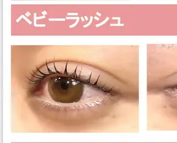 ベビーラッシュ