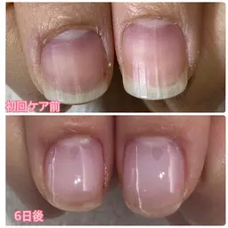 限定モニター価格！人気急増！毎月2名限定！自爪育成ケア（初回ホームケア用品込み）