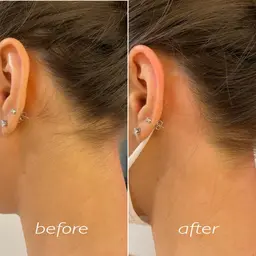 うなじ シュガーリング