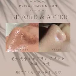 【7.8.9日限定🌸新生活駆け込みに】毛穴洗浄×小顔矯正マッサージ40分［むくみも毛穴もスッキリ◎］